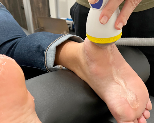 Softwave Therapy for Foot Injuries